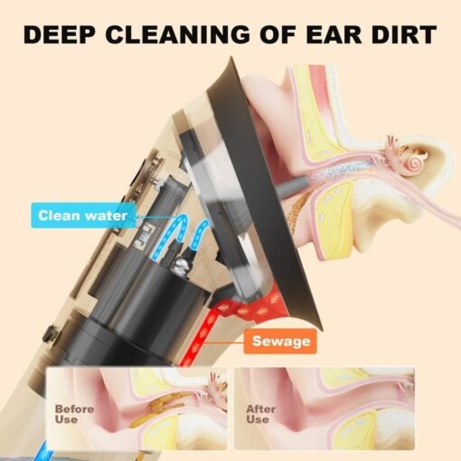 Ear Canal Irrigation Cleaner - Image 7